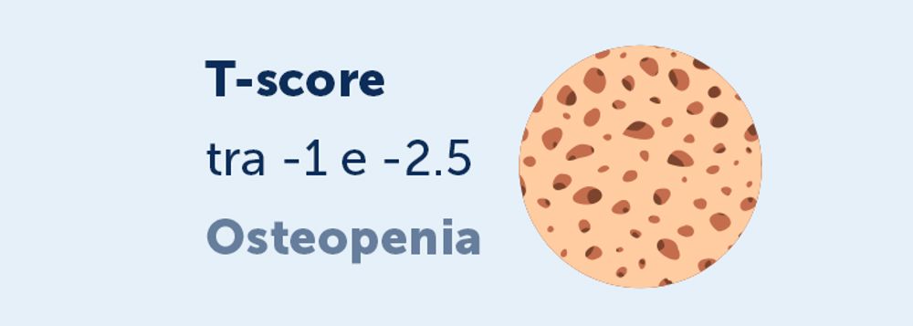 Tscore Osteopenia